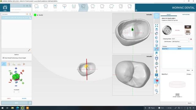 1) Work NC - коронка смотреть онлайн