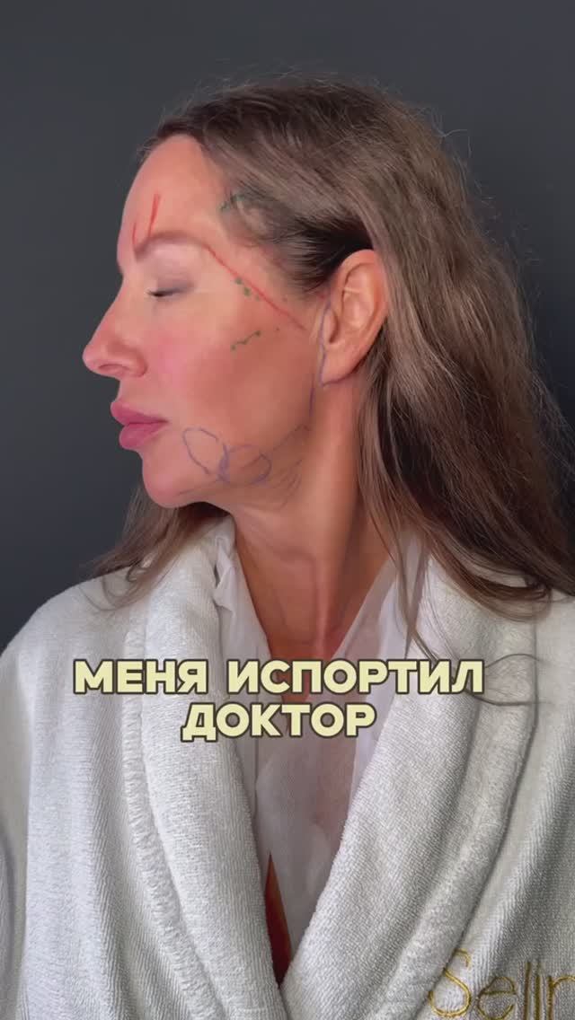 Прошло 4 месяца после пластической операции Total Face! смотреть онлайн