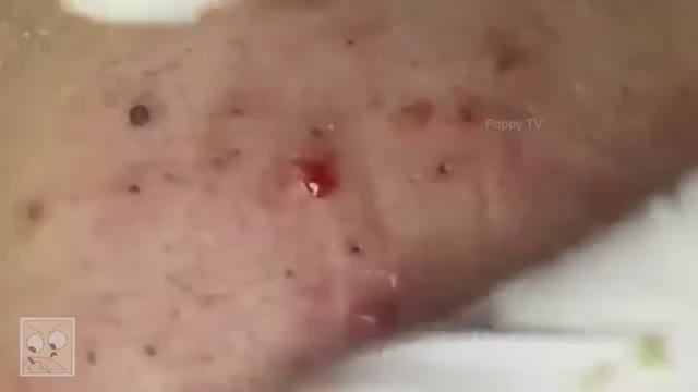 Потрясающие черные точки... это стоит посмотреть! смотреть онлайн