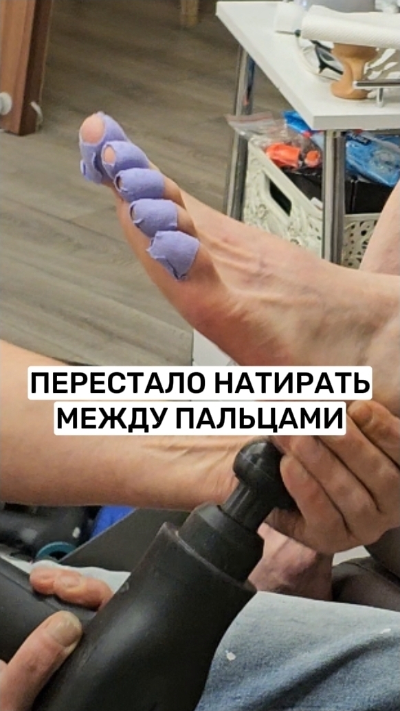 Мозоли теперь перестанут появляться. После приёма расслабились пальцы смотреть онлайн