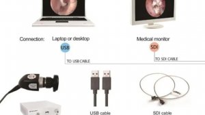 Медицинский эндоскоп 3 в 1 SY-HD7021 совместимый с мобильными устройствами ноутбуками и телевизорами