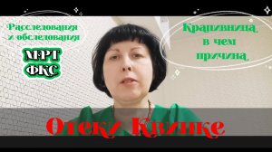 МРТ головного мозга, отеки Квинке и крапивница, СИБР