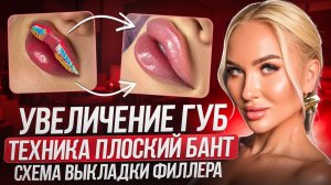 Увеличение губ. Техника плоский бант. Схема выкладки филлера