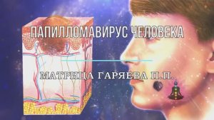 ВИРУС ПАПИЛЛОМЫ (ВПЧ), БОРОДАВКИ, ДОБРОКАЧЕСТВЕННАЯ ОПУХОЛЬ*Оригинальная Матрица Гаряева П.П.