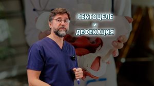 Ректоцеле и дефекация