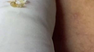 Выдавливание прыщей, угрей, черных точек и камедонов #28