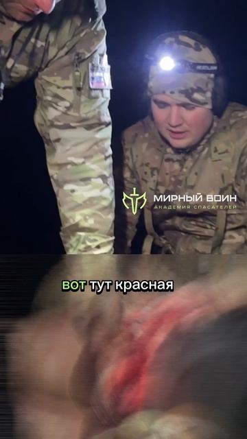 Тампонада раны смотреть онлайн