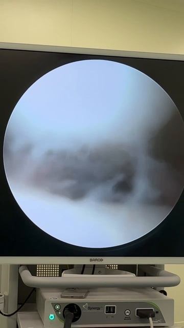 Клинический случай. Боль в коленном суставе