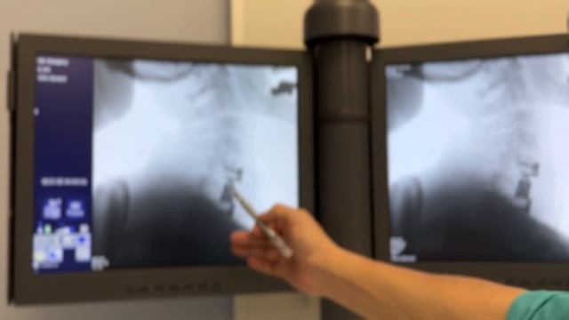 Важная операция на шее