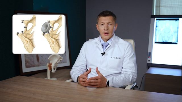 3 симптома, что пора на операцию по замене сустава / Проверь себя, пока еще не поздно! смотреть онлайн