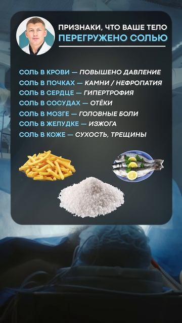 ОПАСНЫЕ признаки избытка СОЛИ! #здоровье #организм #соль смотреть онлайн