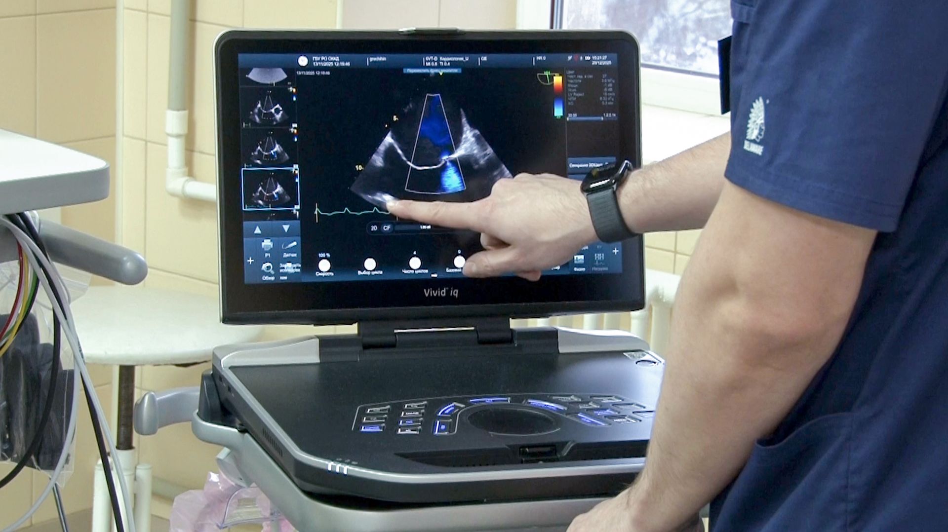 В кардиодиспансере появились новые аппараты для лечения аритмии смотреть онлайн