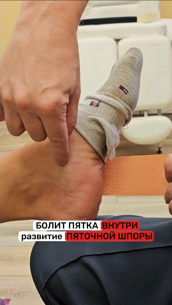 Избавляемся от режущей боли в пятке и останавливаем развитие пяточной шпоры. Сергей Нечипоренко смотреть онлайн