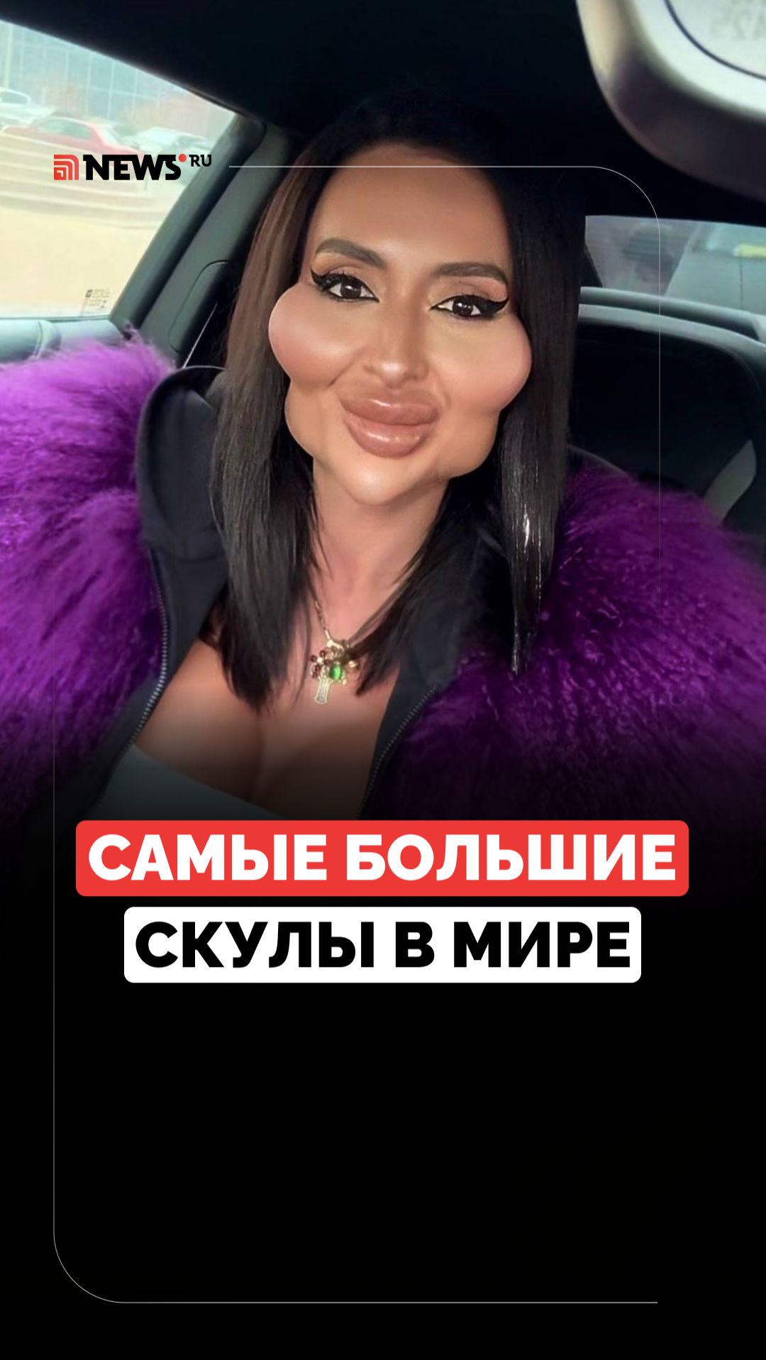 Скулы, губы и ягодицы. На что идёт девушка ради красоты? смотреть онлайн