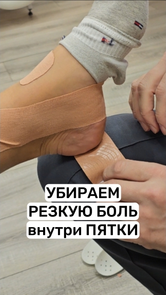 Убираем резкую боль в пятке, техникой тейпирования. Поможет при пяточной шпоре. Сергей Нечипоренко смотреть онлайн