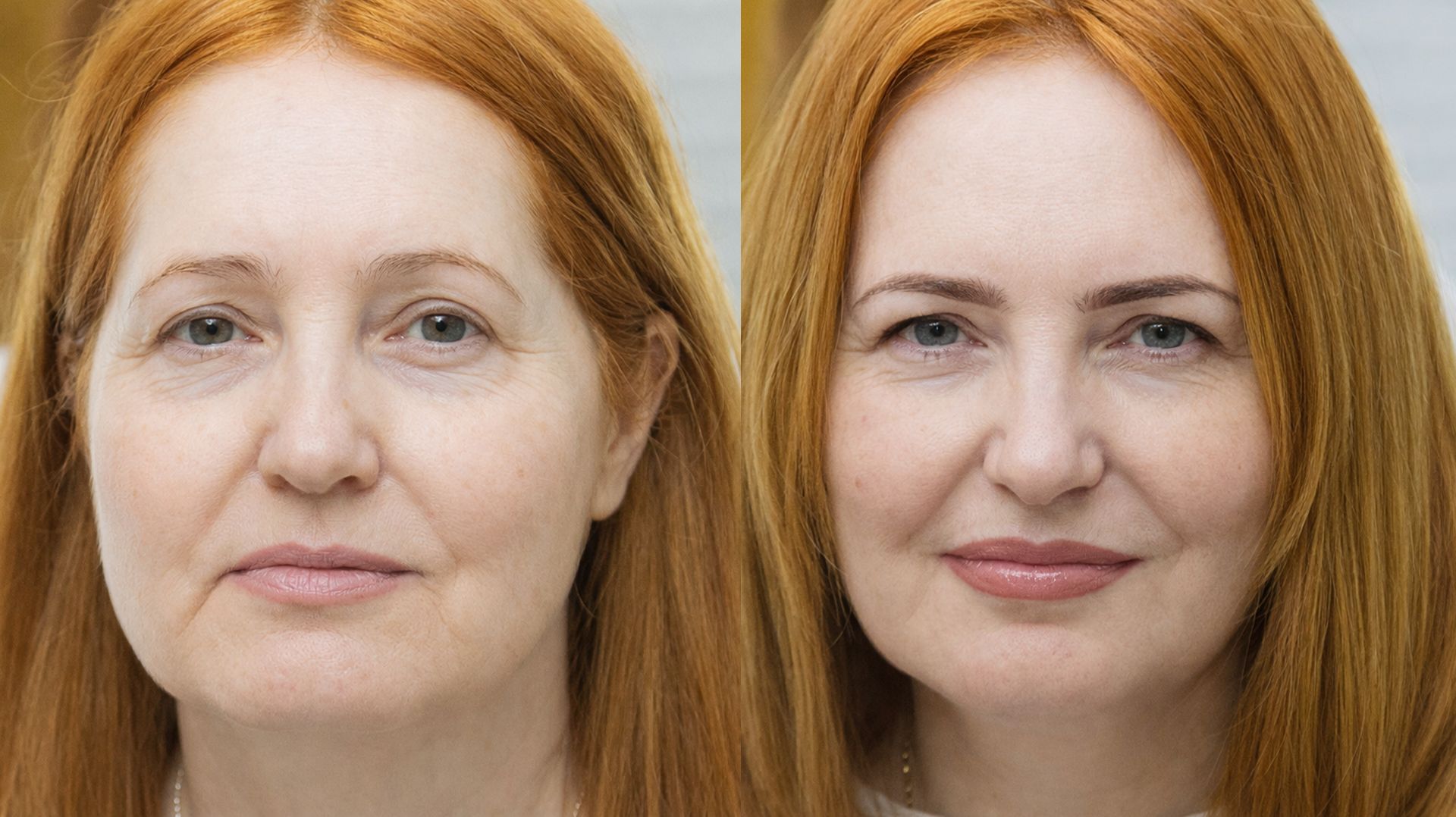 КАК ВЫГЛЯДЕТЬМОЛОЖЕ❓ЖИЗНЬ БЕЗ МАКИЯЖА❓ПЕРМАНЕНТНЫЙ МАКИЯЖ #БРОВИ#ГУБЫ#МЕЖРЕСНИЧКА смотреть онлайн