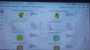 Омоложение при приеме фуллеренов! 
Что происходит внутри организма?