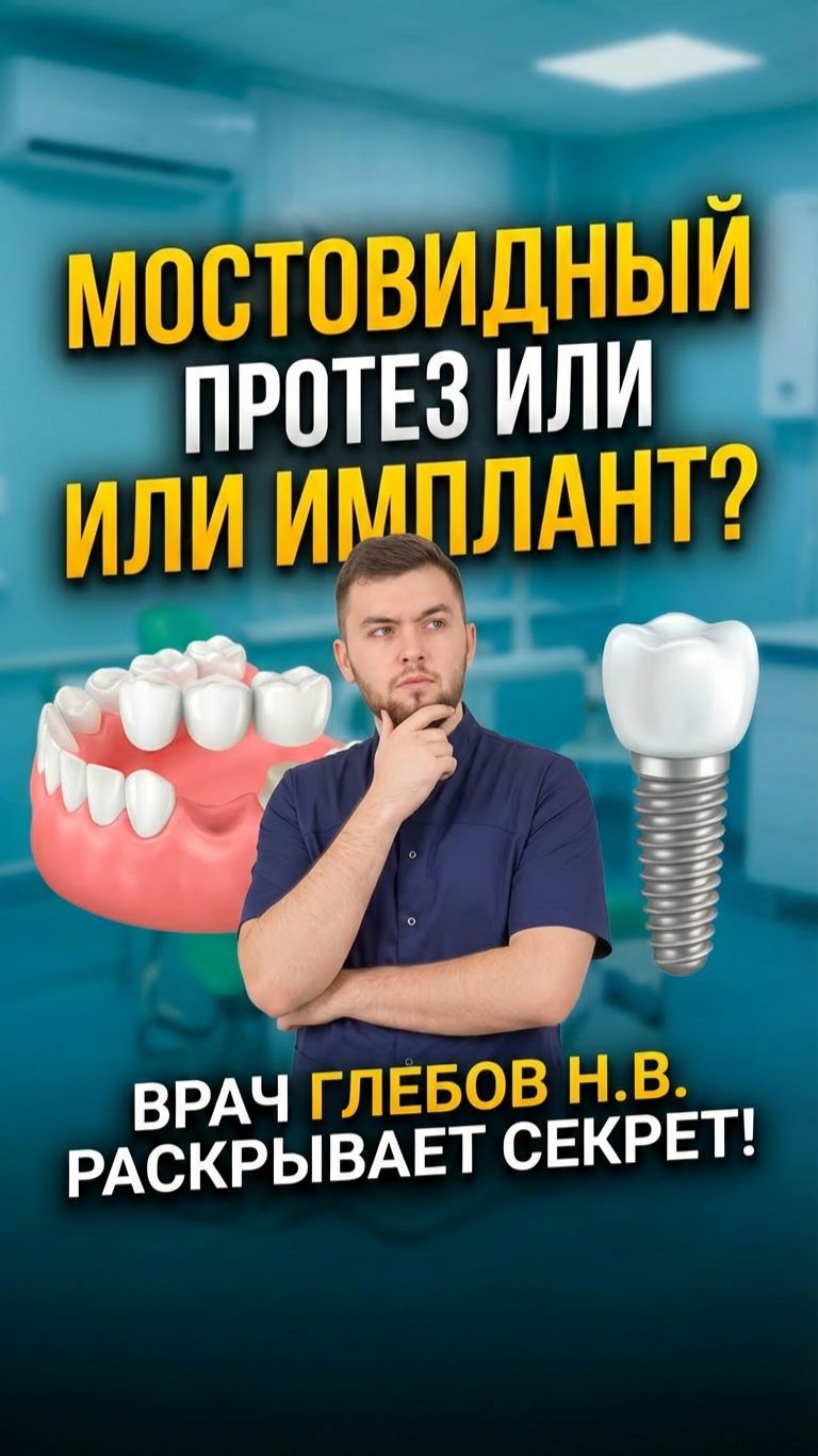 Что выбрать имплант или мост? смотреть онлайн