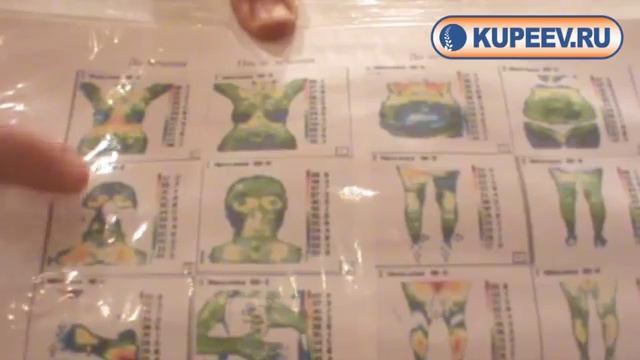 «Возможно ли полностью вылечить любые заболевания суставов» — профессор медицины Купеев В.Г. смотреть онлайн