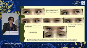 Секция 4 «Лечение пациентов с несодружеств. формами косоглазия: стратегия, тактика, методы» Часть 1