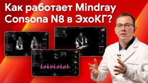 Эхокардиография на УЗИ аппарате Mindray Consona N8: как справляется прибор?