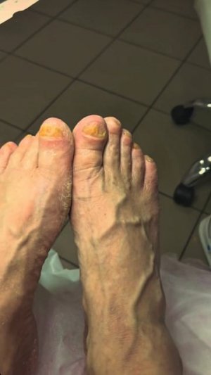 НОЖКИ МОНГОЛА ПРЕОБРАЗИЛИСЬ! РОДНУЛЬКИНЫ, СЛЕДИТЕ ЗА СВОИМ ЗДОРОВЬЕМ 🙏🏻