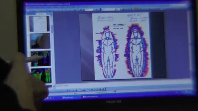 1-4 Золотарев обследутся в клинике Купеева, ФитоЛазероФорез. смотреть онлайн