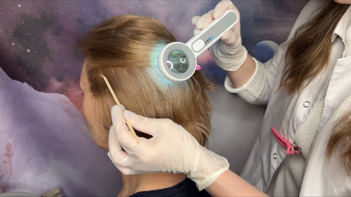 АСМР Осмотр Кожи Головы и Волос (с реальным человеком) • ДЛЯ 10000% СНА И МУРАШЕК! • ASMR Scalp exam смотреть онлайн