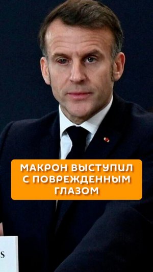 Макрон выступил с поврежденным глазом