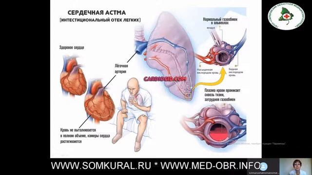 21 Сосуды малого круга кровообращения Кровообращение плода