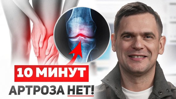 Артроз - это НЕ ПРИГОВОР! Как остановить или предотвратить артроз в ЛЮБОМ ВОЗРАСТЕ!