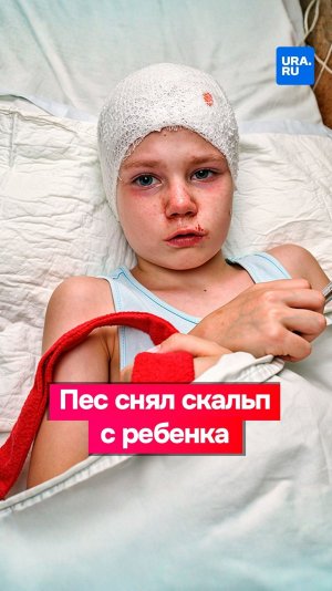 Пес снял скальп со школьницы в Хакасии