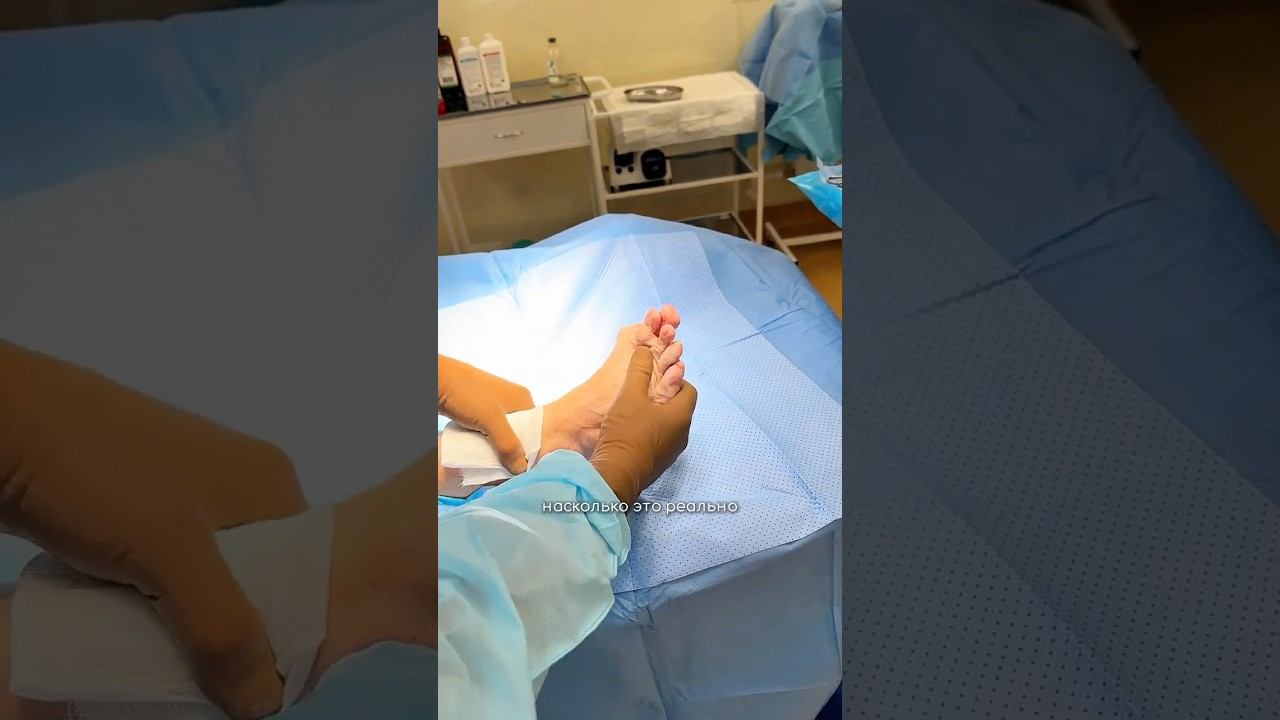 Сложная стопа: что дает операция и зачем она нужна? Ортопед-травматолог клиники «АБИА»