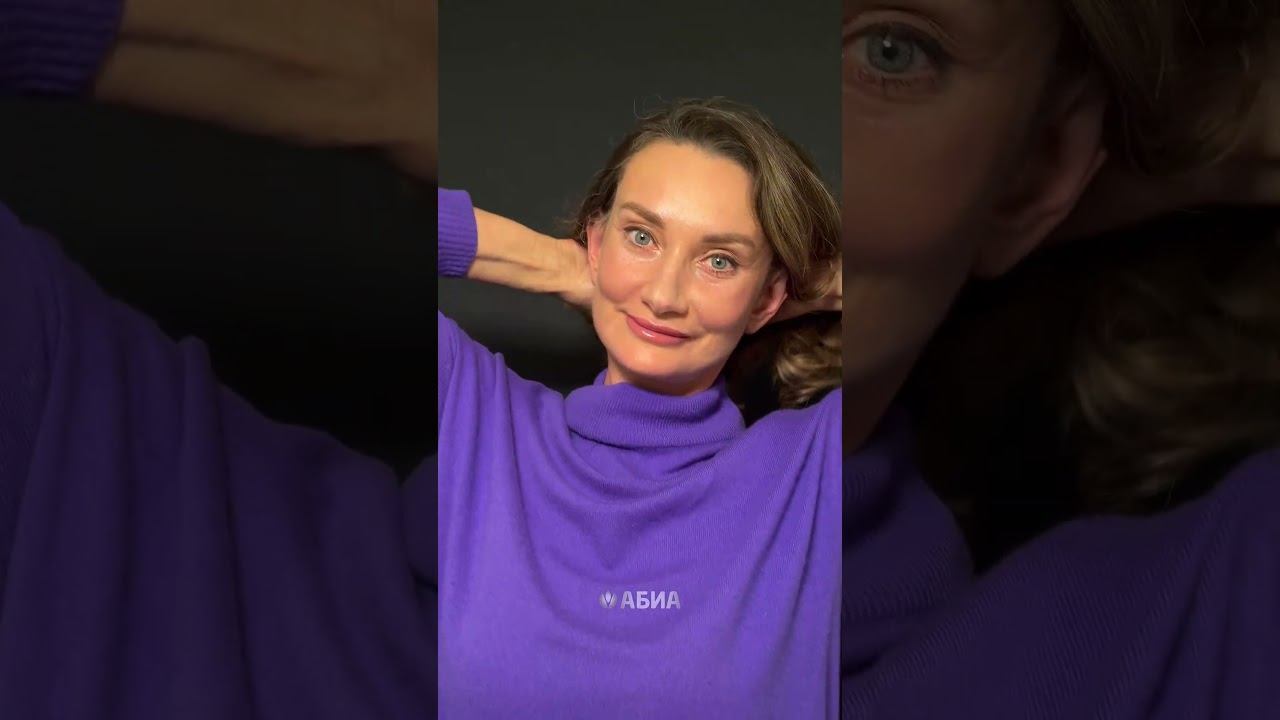 Выполнена глубокая подтяжка лица Deep Plane, эндоскопический лобно-височный лифтинг, блефаропластика