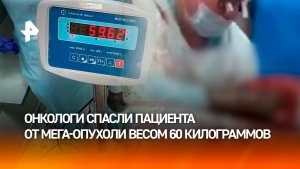 60 кг ужаса: свердловские онкологи вырезали гигантскую опухоль