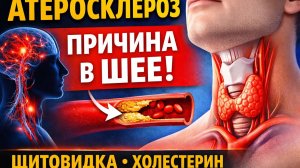 Атеросклероз: скрытая причина в шее, о которой не говорят