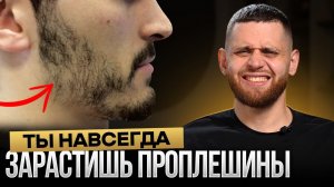10 советов как зарастить проплешины и сделать бороду густой