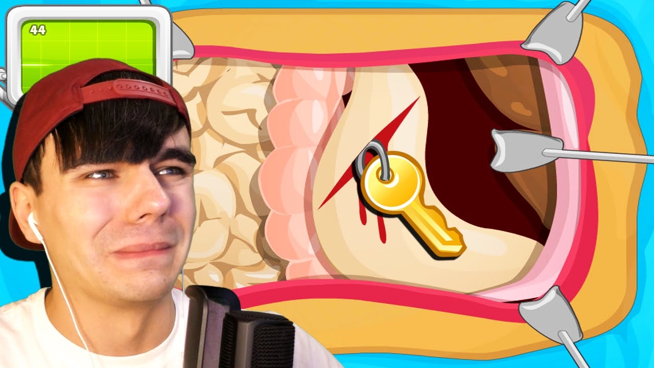 НАШЁЛ КЛЮЧИ В ЖЕЛУДКЕ