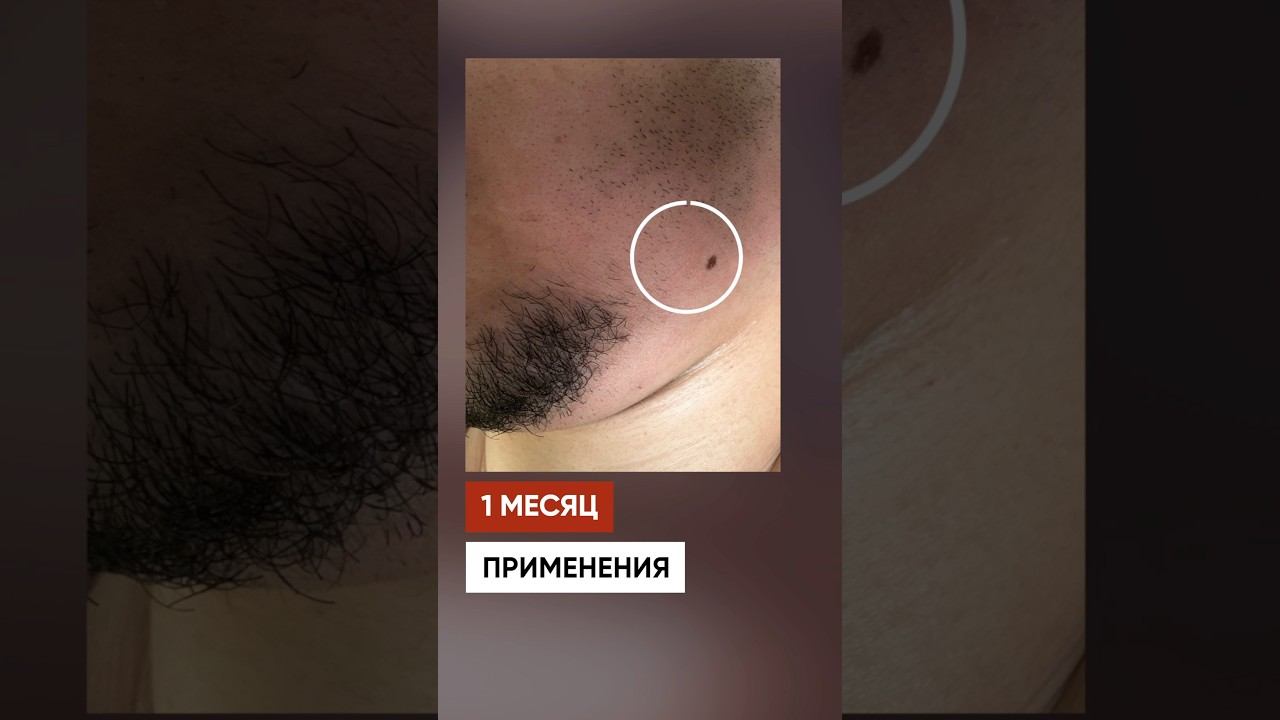 БУСТ ДЛЯ БОРОДЫ: вот так работает Mr.Volos