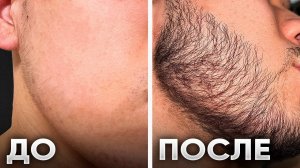 Отрастил ГОЛЛИВУДСКУЮ бороду за 2,5 месяца / результаты Киркланд