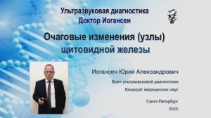 Ультразвуковая диагностика (УЗИ). Доктор Иогансен. Очаговые изменения (узлы) щитовидной железы..