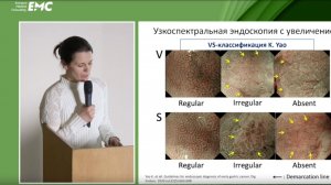 2. Кулагина О.А. Эндоскопическая диагностика поверхностных эпителиальных новообразований желудка.