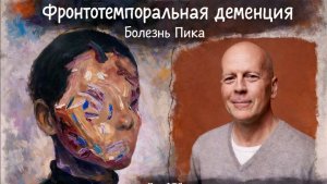 Фронтотемпоральная деменция (ЛВД)