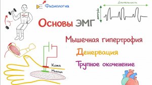 Электромиография (ЕМГ)