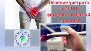 Лечение уретрита и ИППП фотодинамической терапией