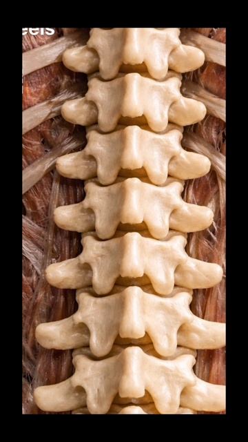 Тейпирование при напряжении и боли в спине смотреть онлайн