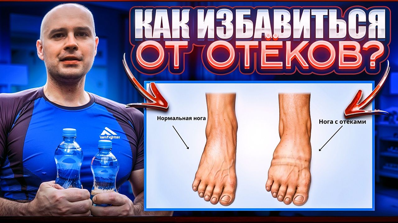 Как избавиться от отёков? смотреть онлайн