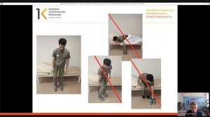 Реабилитация в домашних условиях после перелома шейки бедра