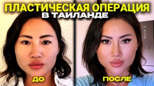 Вместо отпуска — ОПЕРАЦИЯ! Сколько стоит блефаропластика в Таиланде, довольна ли я результатом? 2026