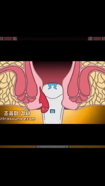 Корейцы показали, почему важно обращаться к врачам на начальной стадии заболевания, и не запускать смотреть онлайн